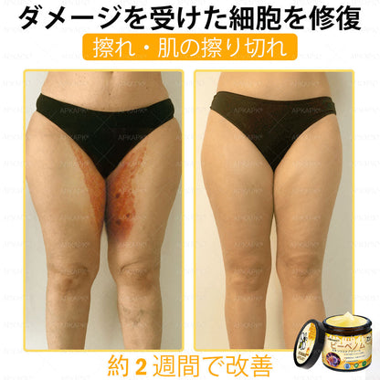 ✨✨APKAPK® 𝗠É𝗛𝗠É𝗥𝗘𝗚 総合クリーム🥇 皮膚の隆起に対するケアには以下が含まれます： 加齢によるシミ、傷跡、いぼ、皮膚の隆起、脂肪の塊、ニキビ、湿疹、乾癬、反転性ニキビ、しわ、皮膚の老化およびその他の問題🔥