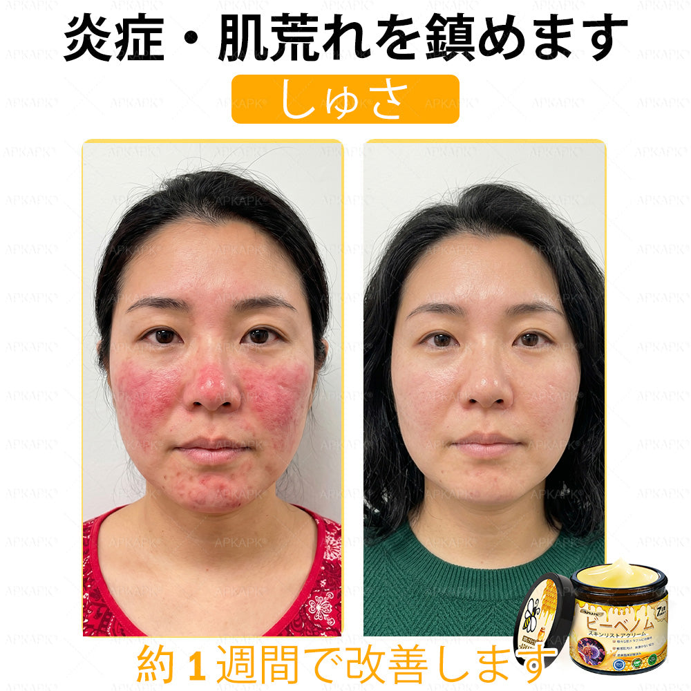 ✨✨APKAPK® 𝗠É𝗛𝗠É𝗥𝗘𝗚 総合クリーム🥇 皮膚の隆起に対するケアには以下が含まれます： 加齢によるシミ、傷跡、いぼ、皮膚の隆起、脂肪の塊、ニキビ、湿疹、乾癬、反転性ニキビ、しわ、皮膚の老化およびその他の問題🔥