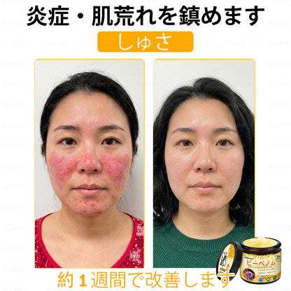 ✨✨APKAPK® 𝗠É𝗛𝗠É𝗥𝗘𝗚 総合クリーム🥇 皮膚の隆起に対するケアには以下が含まれます： 加齢によるシミ、傷跡、いぼ、皮膚の隆起、脂肪の塊、ニキビ、湿疹、乾癬、反転性ニキビ、しわ、皮膚の老化およびその他の問題🔥