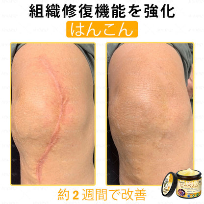 ✨✨APKAPK® 𝗠É𝗛𝗠É𝗥𝗘𝗚 総合クリーム🥇 皮膚の隆起に対するケアには以下が含まれます： 加齢によるシミ、傷跡、いぼ、皮膚の隆起、脂肪の塊、ニキビ、湿疹、乾癬、反転性ニキビ、しわ、皮膚の老化およびその他の問題🔥