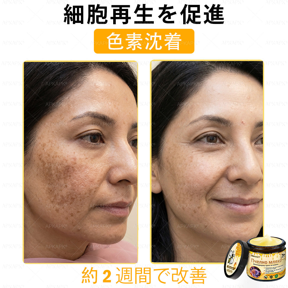 ✨✨APKAPK® 𝗠É𝗛𝗠É𝗥𝗘𝗚 総合クリーム🥇 皮膚の隆起に対するケアには以下が含まれます： 加齢によるシミ、傷跡、いぼ、皮膚の隆起、脂肪の塊、ニキビ、湿疹、乾癬、反転性ニキビ、しわ、皮膚の老化およびその他の問題🔥